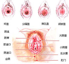 处女膜结构图